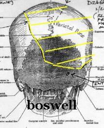 t13f7bb Boswell