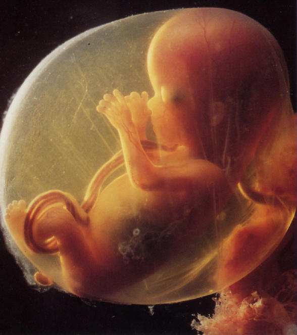Abtreibung Pro Life Vs Pro Choice Seite 197 Allmystery