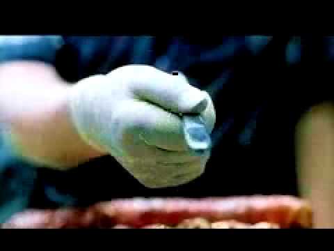 Youtube: Anatomy (German trailer)