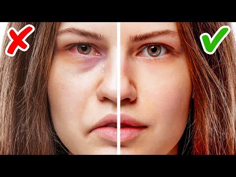 Youtube: 11 Zeichen für Gesundheitsprobleme, erkennbar an deinem Gesicht