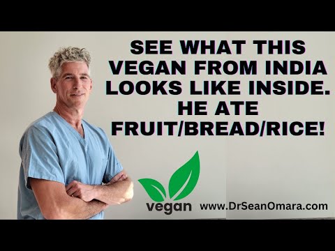 Youtube: New VEGAN Client from India: ^^^Visceral Fat, TOFI, Why Vegans & Everyone should be scanned by MRI.