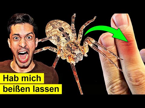 Youtube: Nosferatu-Spinne in Deutschland: Das passiert, wenn sie dich beißt