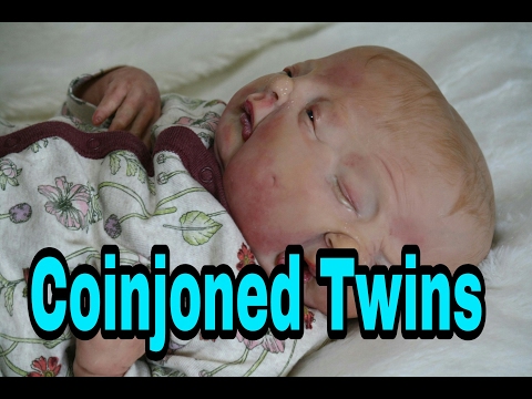 Youtube: SPECIAL Box Opening! Two Faced Baby! Twin Baby Girls Born With Two Faces One Body!
